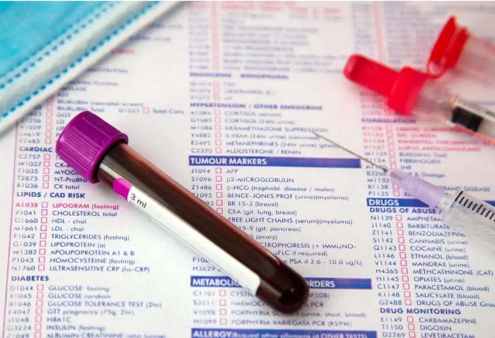 Testing for PANDAS/PANS: Giving Your Child The Best Chance for Recovery