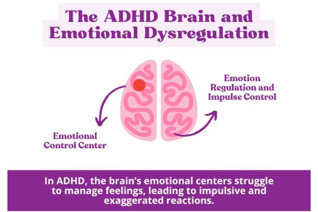 Brain infographic showing ADHD emotional centers and impulse control