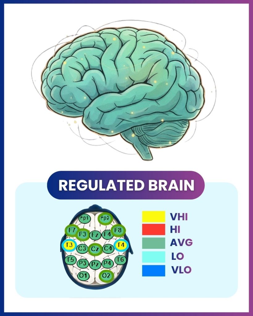 Illustration of a regulated brain with color-coded processing regions and activity levels