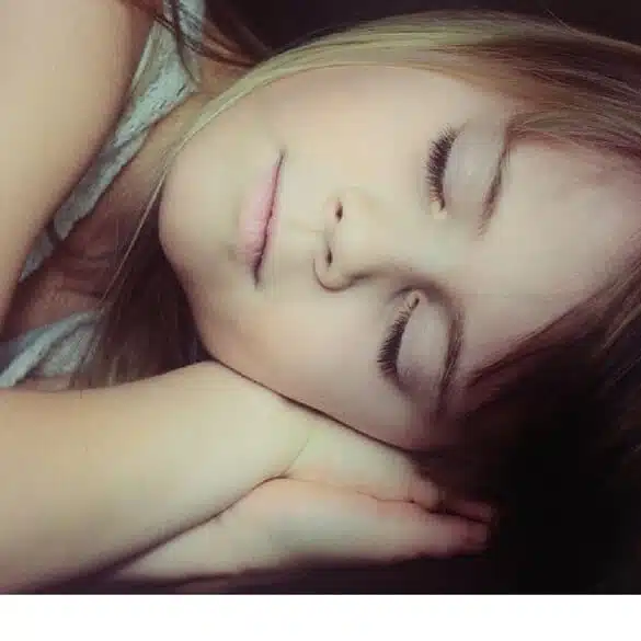 Young girl sleeping - Enuresis - Bed Wetting Treatment