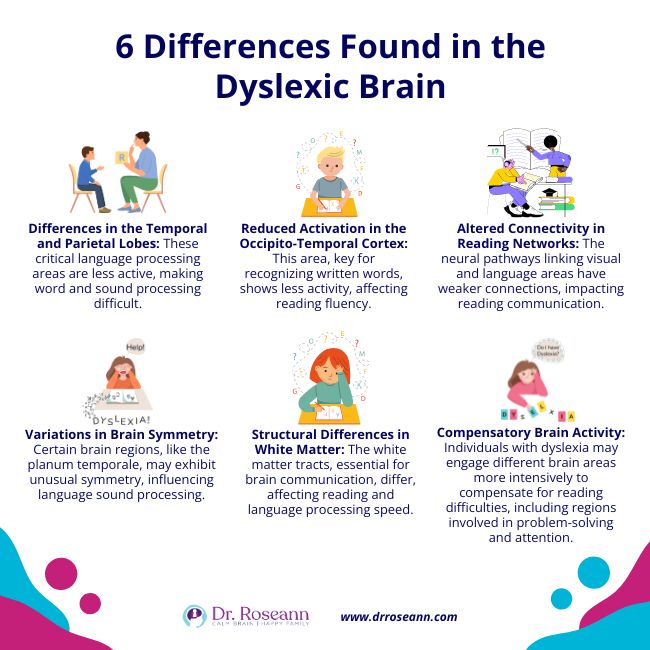 6 Differences Found in the Dyslexic Brain