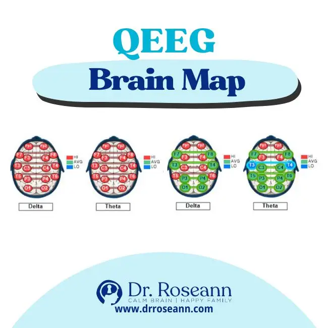 Neurofeedback for OCD: QEEG Brain Map Analysis