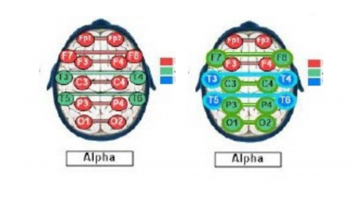 A case study exploring the impact of alpha and gamma brain activity on mood and behavior is depicted through two diagrams.