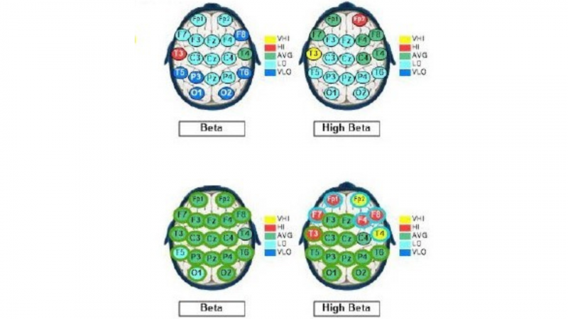 A diagram illustrating various egg types featured in an ADHD case study.